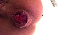 hd 22летняя пролапс бутона розы cu arrombado с разбитой дырой анальная свинья экстремальный хардкорный фетиш sex