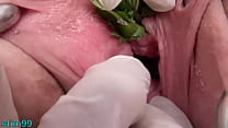 hd video nettles in peehole urethral insertion nettles fisting cunt sex